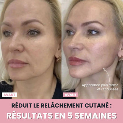 LenaSilk Sculpteur Facial LED 7 en 1
