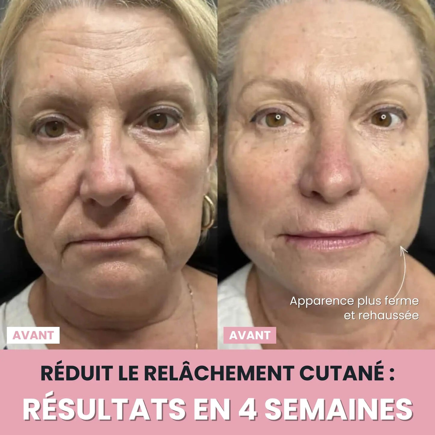 LenaSilk Sculpteur Facial LED 7 en 1
