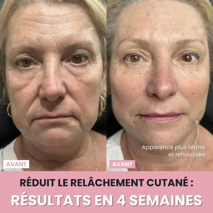 LenaSilk Sculpteur Facial LED 7 en 1