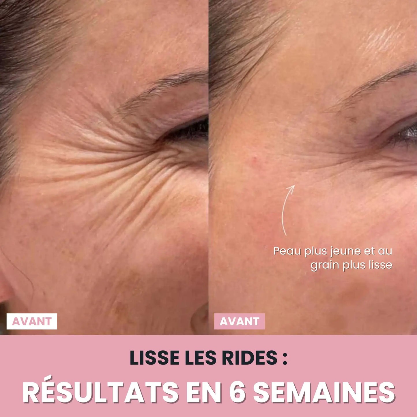 LenaSilk Sculpteur Facial LED 7 en 1