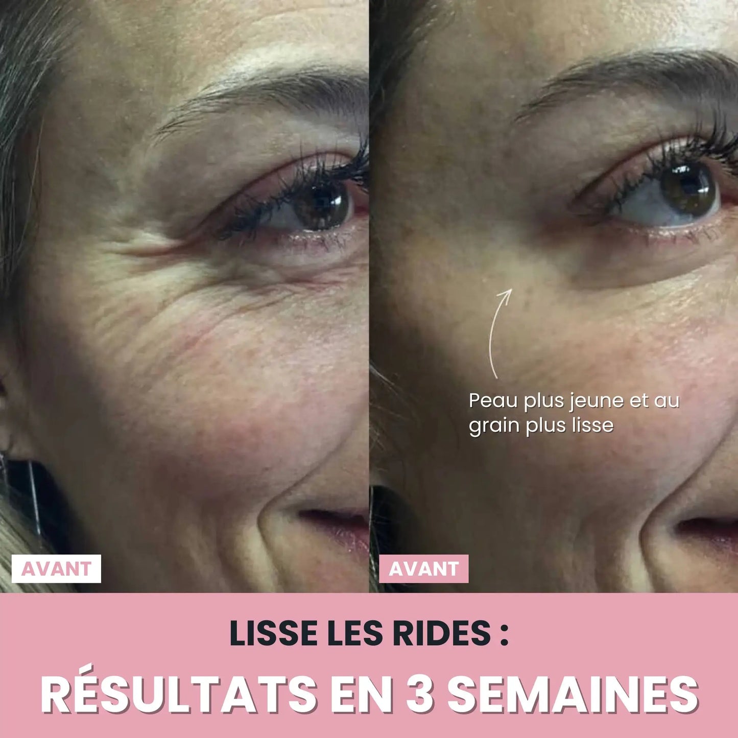 LenaSilk Sculpteur Facial LED 7 en 1