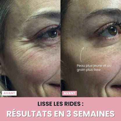 LenaSilk Sculpteur Facial LED 7 en 1