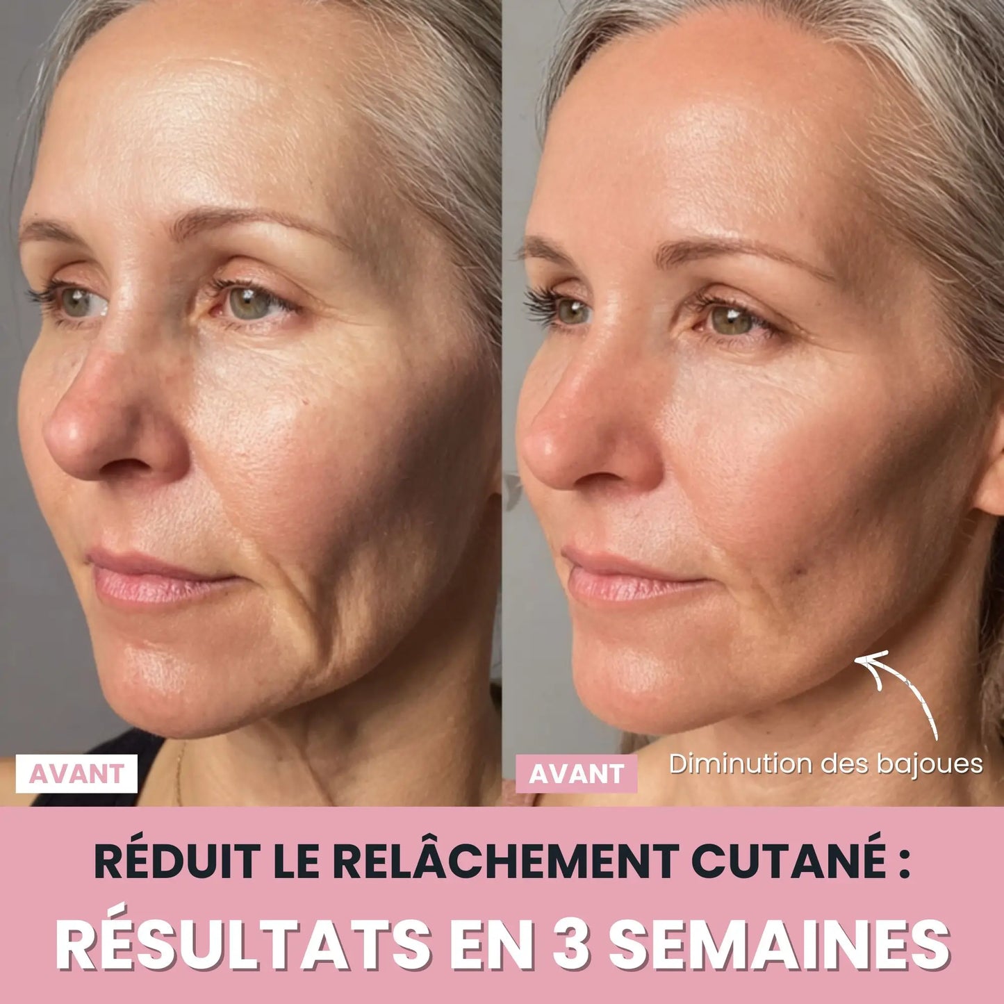 LenaSilk Sculpteur Facial LED 7 en 1
