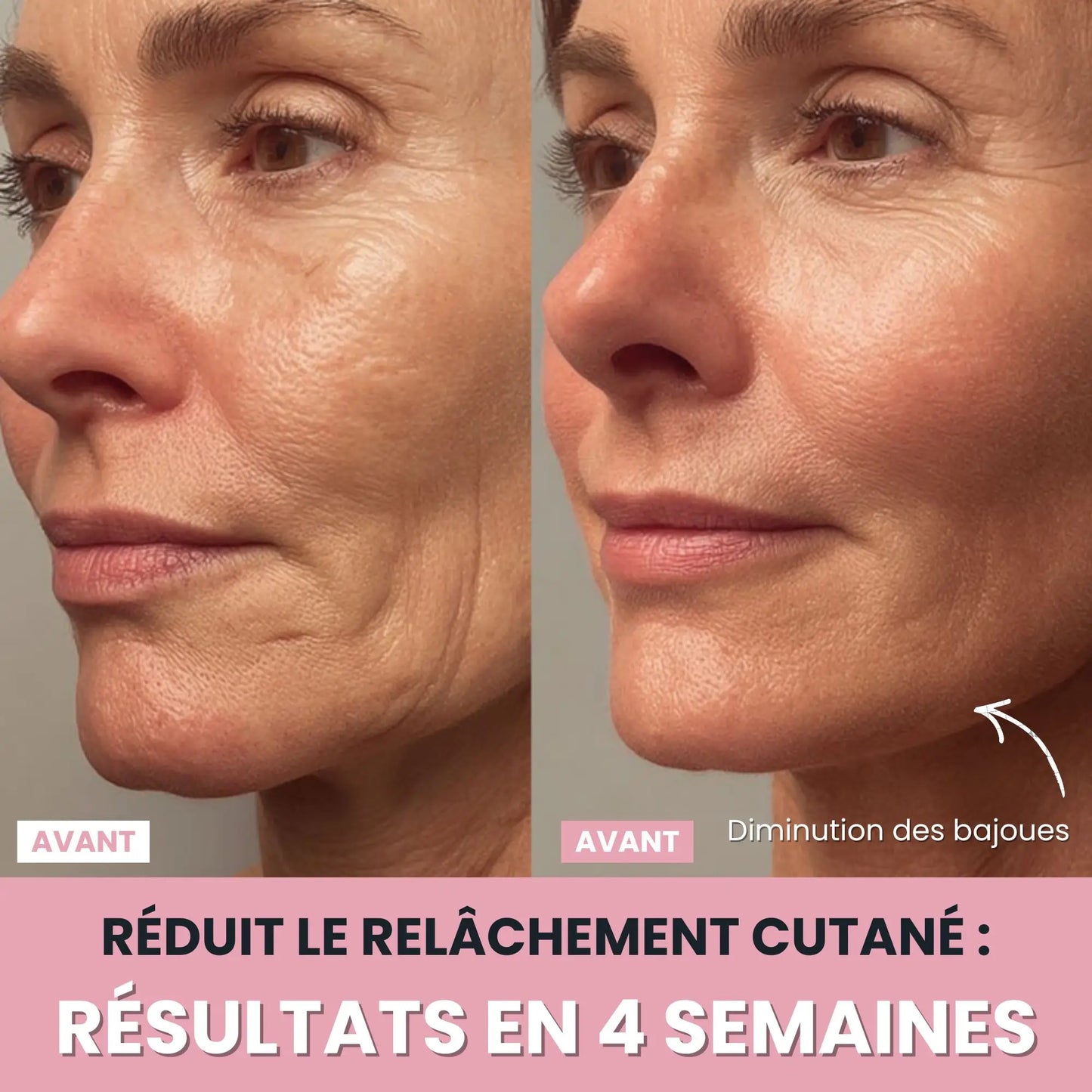 LenaSilk Sculpteur Facial LED 7 en 1