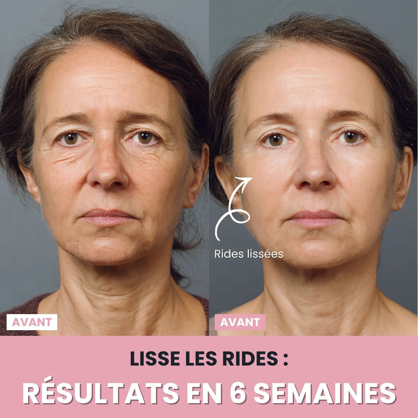 LenaSilk Sculpteur Facial LED 7 en 1