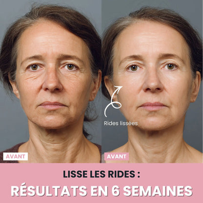 LenaSilk Sculpteur Facial LED 7 en 1